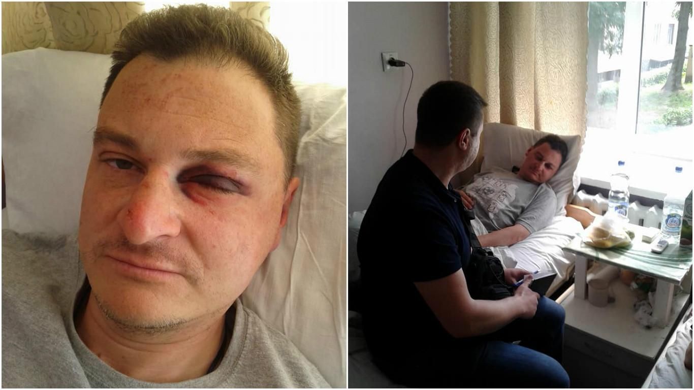 Неизвестные жестко избили и ограбили журналиста в Житомире