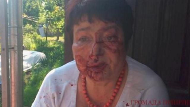 На Київщині сильно побили голову ТВК: одного з нападників вдалось затримати