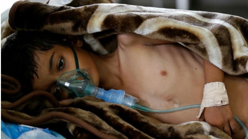 Кількість жертв від епідемії холери в Ємені збільшилась: жахаючі дані