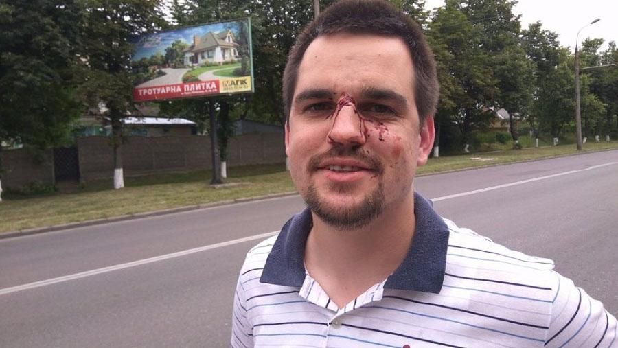 Бійця АТО жорстоко побили у Луцьку: з'явились фото