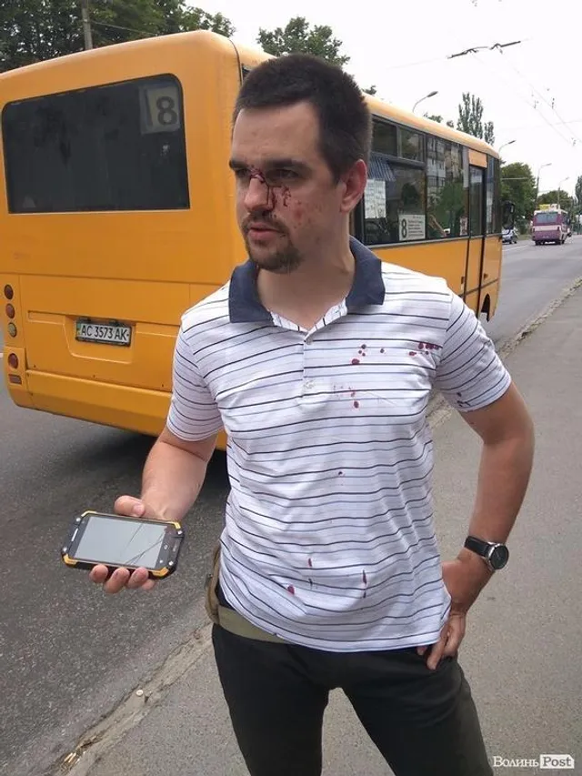 Бійця АТО Андрій Д’яченка побили у Луцьку Бійця АТО Андрій Д’яченка побили у Луцьку