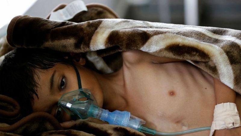 Спалах холери у Ємені: інфекція шириться дуже швидко, більше тисячі загиблих