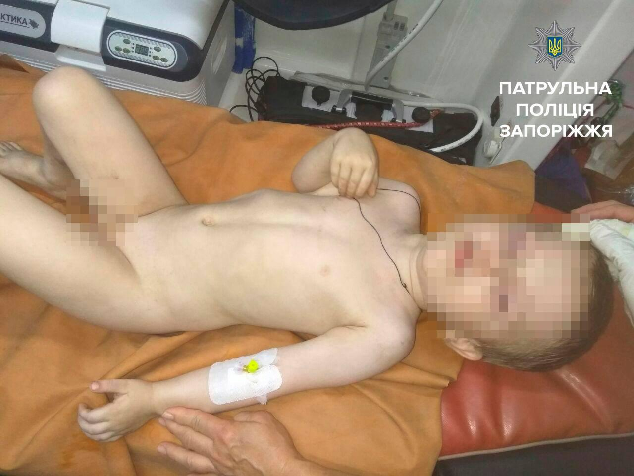 В Запорожье из окна дома выпал ребенок