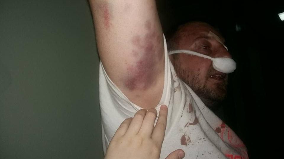 Полиция жестоко избила добровольца АТО в Киеве, – волонтеры