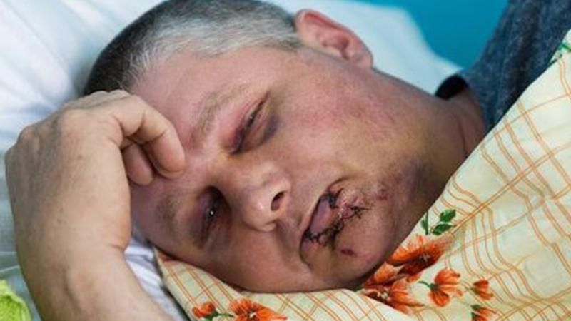 На Донбассе жестко избили молодого человека и ветерана АТО за проукраинские лозунги