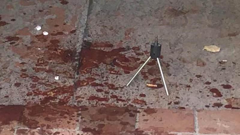 Невідомі пограбували та розстріляли чоловіка у Києві: фото з місця злочину (18+) Невідомі пограбували та розстріляли чоловіка у Києві: фото з місця злочину (18+)