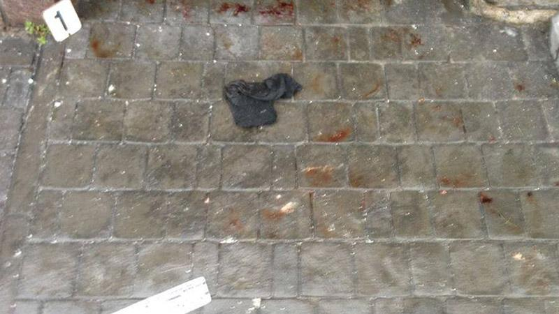 Под Киевом прогремел взрыв возле дома предпринимателей: пострадали супруги