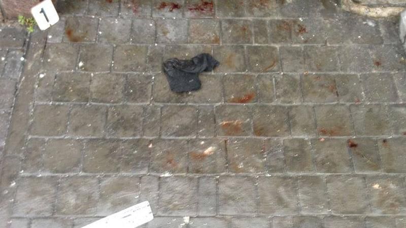 Под Киевом прогремел взрыв возле дома предпринимателей: пострадали супруги Под Киевом прогремел взрыв возле дома предпринимателей: пострадали супруги