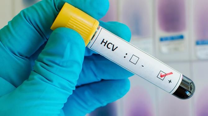 Епідемія гепатиту С: 95% хворих не знають про свій діагноз Епідемія гепатиту С: 95% хворих не знають про свій діагноз