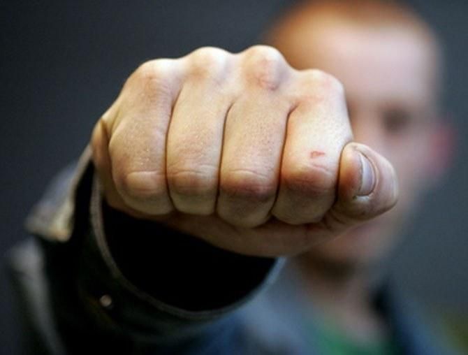 Иностранец избил ногой полицейского в Одессе: милиционера госпитализировали Иностранец избил ногой полицейского в Одессе: милиционера госпитализировали