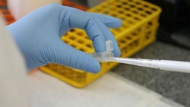 Холера у Миколаєві: в місті закрили усі пляжі Холера у Миколаєві: в місті закрили усі пляжі