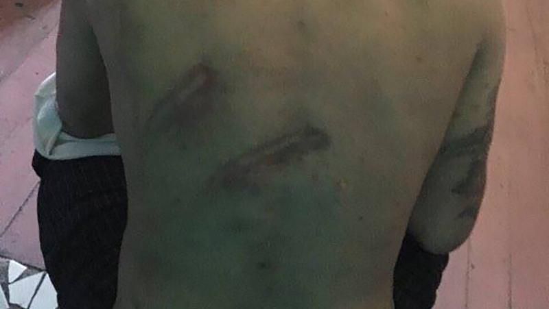 Новый скандал в Одесском СИЗО: прокуратура сделала заявление об избиении задержанных Новый скандал в Одесском СИЗО: прокуратура сделала заявление об избиении задержанных