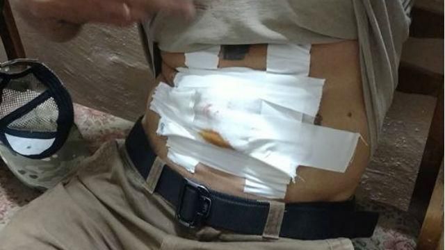 В Одесі стріляли в активіста В Одесі стріляли в активіста