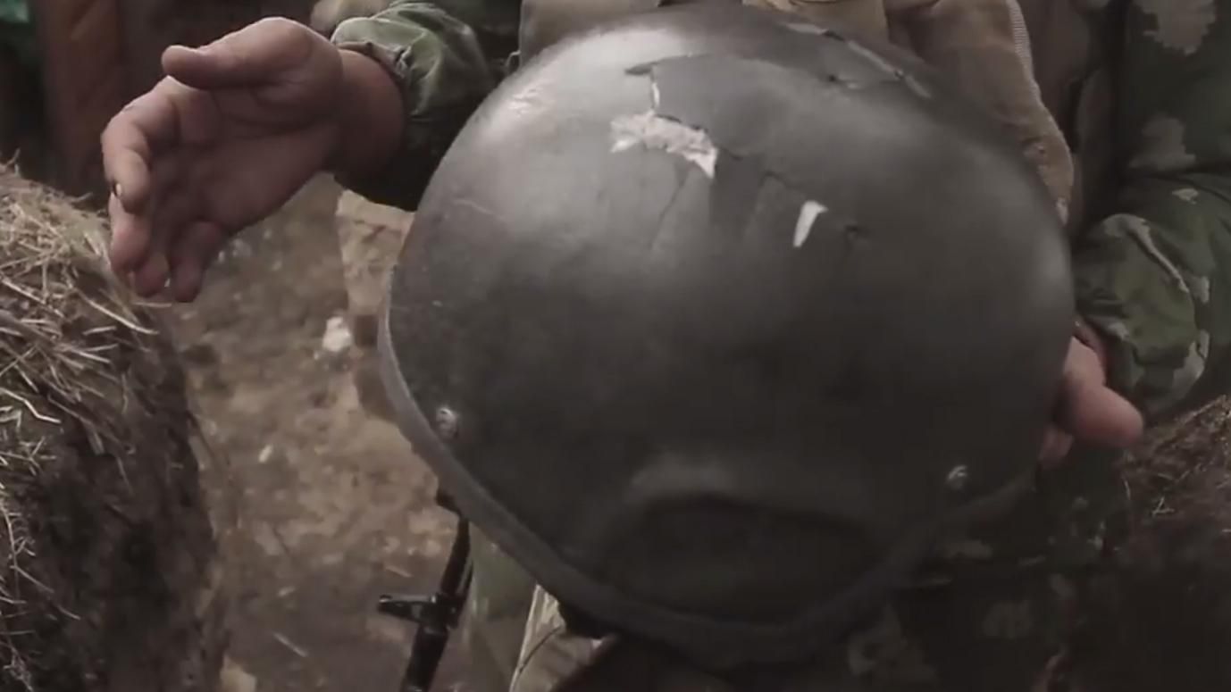 Украинский воин чудом выжил после очередного обстрела террористов на Донбассе