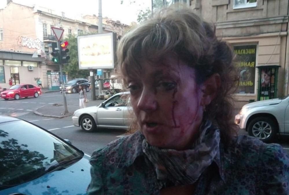 В Одесі посеред вулиці побили відому активістку
