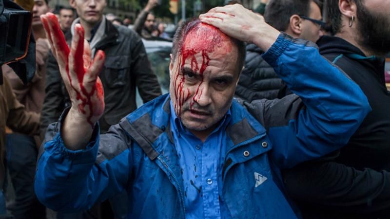 Референдум в Каталонии: растет число пострадавших в результате столкновений Референдум в Каталонии: растет число пострадавших в результате столкновений
