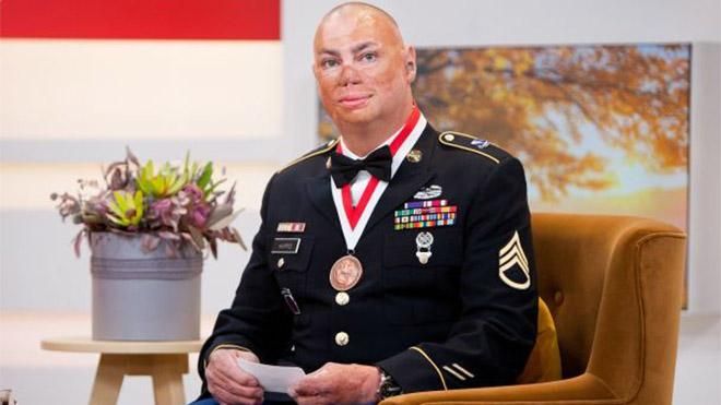 Жага до життя: американський герой, який переніс 75 операцій, зустрівся з ветеранами АТО