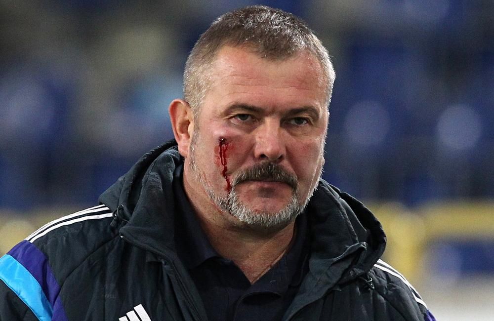 У поліції розповіли, хто відповідатиме за побиття нардепа Берези під час футбольного матчу У поліції розповіли, хто відповідатиме за побиття нардепа Берези під час футбольного матчу