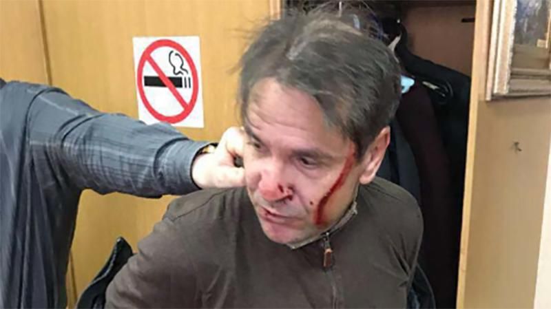 У напавшего на журналистку в Москве серьезные научные достижения У напавшего на журналистку в Москве серьезные научные достижения