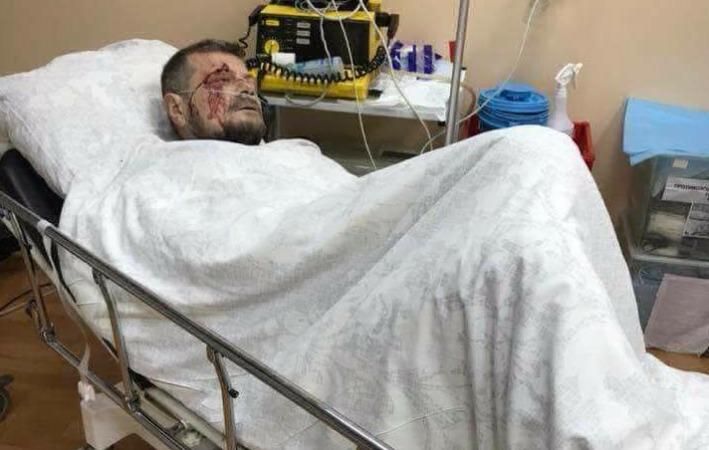 Появились первые фото раненого Мосийчука
