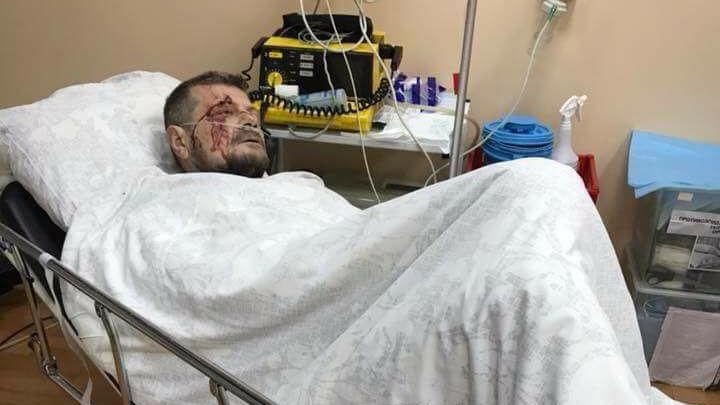 Мосійчук прокоментував замах на нього і назвав замовників Мосійчук прокоментував замах на нього і назвав замовників