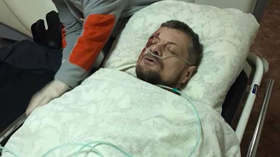 Покушение на Мосийчука – это... Ваше мнение Покушение на Мосийчука – это... Ваше мнение