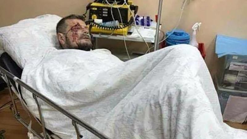 Бомбу встановили за 20 хвилин до виходу Мосійчука, – радник МВС Бомбу встановили за 20 хвилин до виходу Мосійчука, – радник МВС