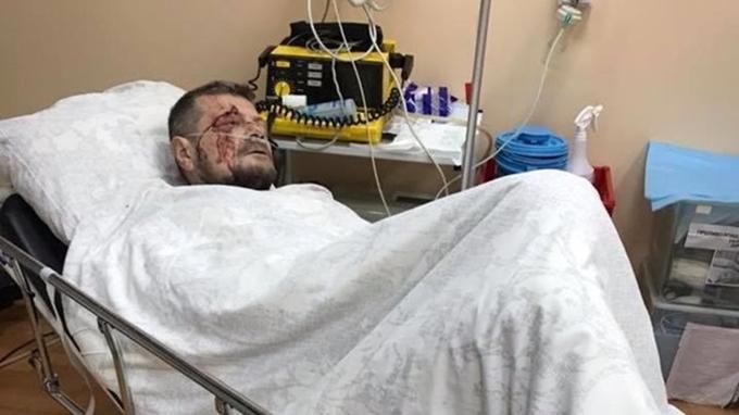 Пораненому депутату Мосійчуку зроблять другу операцію Пораненому депутату Мосійчуку зроблять другу операцію