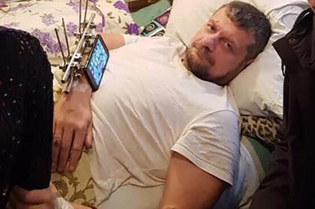 Медики рассказали о состоянии здоровья раненого Мосийчука