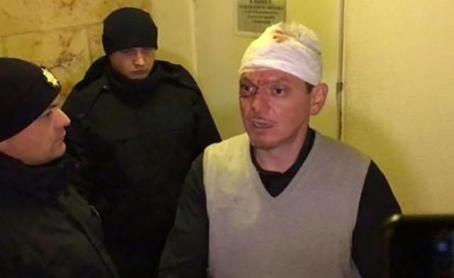 Священник, который устроил "пьяное" ДТП на Ровенщине, оказался рецидивистом Священник, который устроил "пьяное" ДТП на Ровенщине, оказался рецидивистом