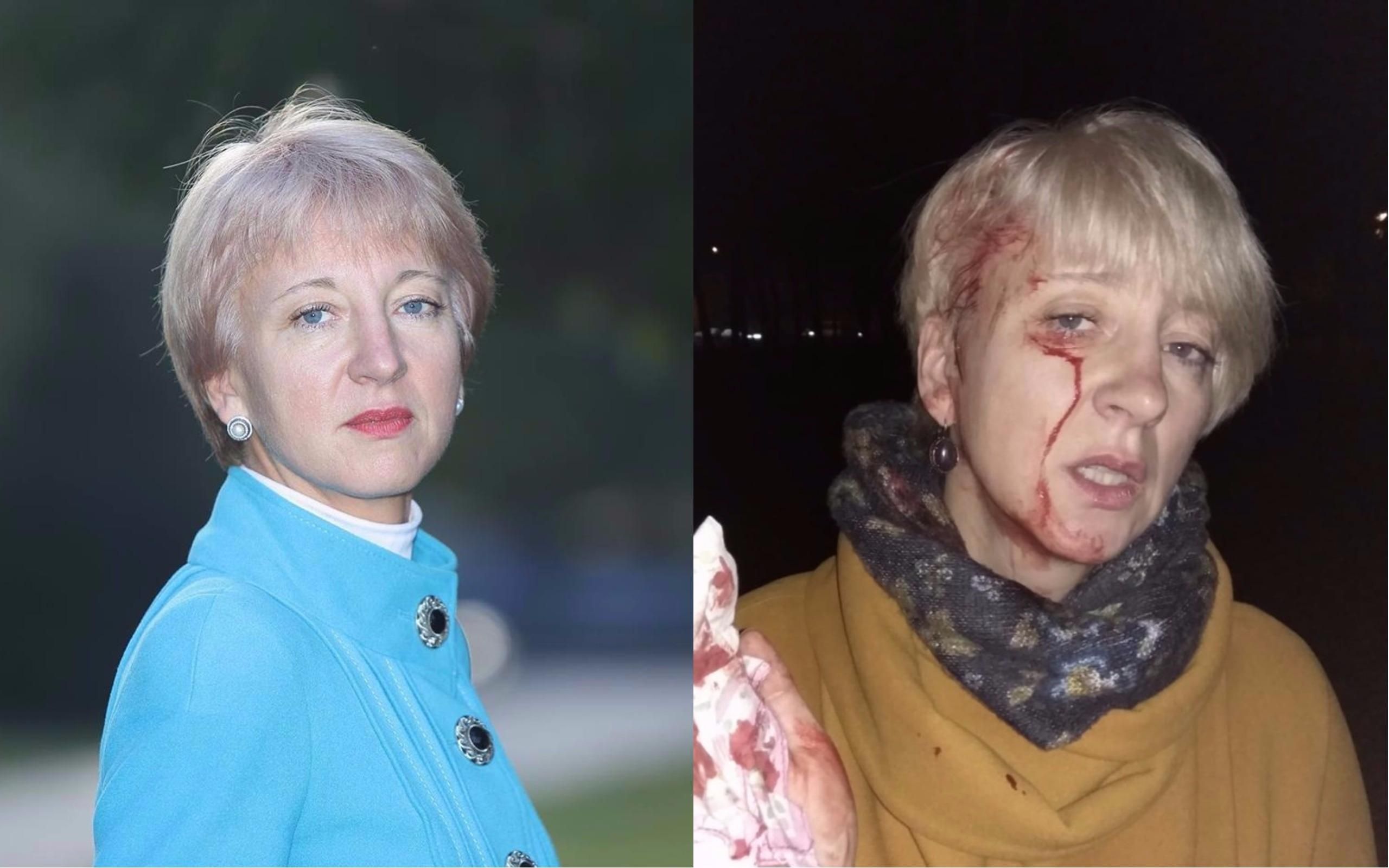 Побита суддя Гольник назвала імена замовників нападу на неї Побита суддя Гольник назвала імена замовників нападу на неї