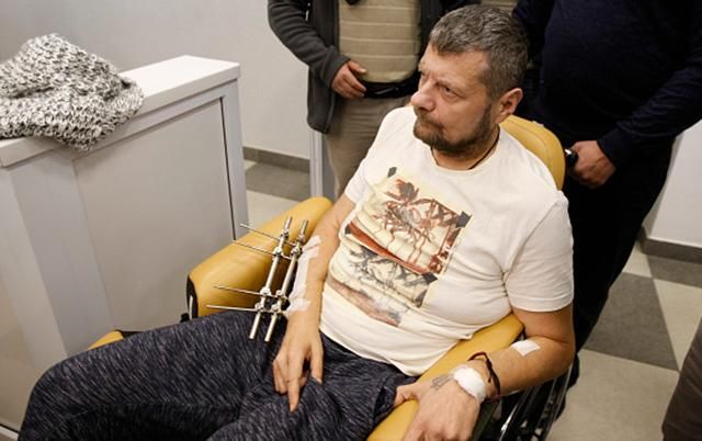 Мосийчуку сделали операцию: вытащили пулю из ноги Мосийчуку сделали операцию: вытащили пулю из ноги