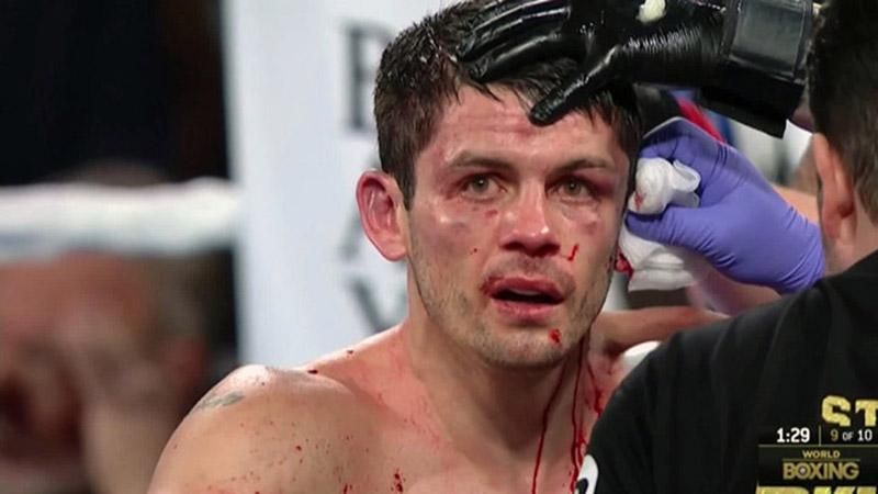 Британський боксер ледь не втратив вухо під час бою: моторошне відео Британський боксер ледь не втратив вухо під час бою: моторошне відео