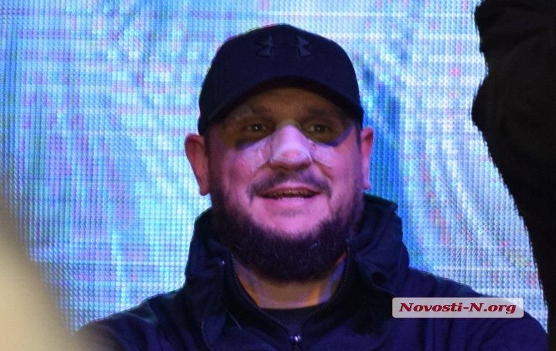 Глава Николаевской ОГА пришел зажигать елку с разбитым носом и синяками: видео Глава Николаевской ОГА пришел зажигать елку с разбитым носом и синяками: видео