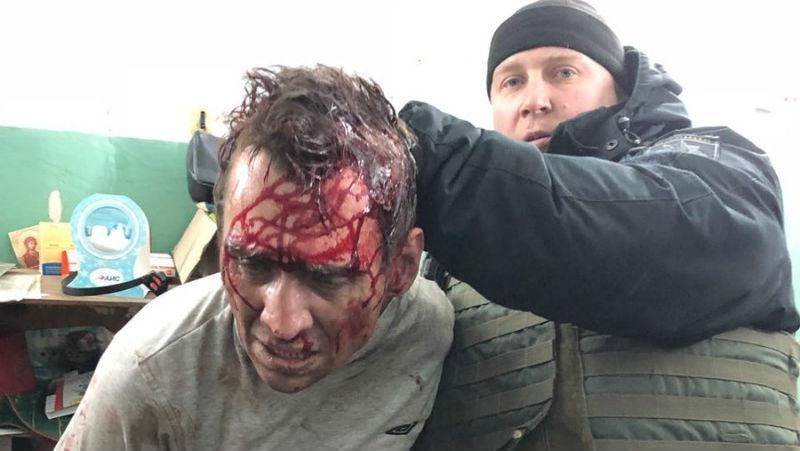 Захват почты в Харькове: в полиции рассказали детали о задержанном Захват почты в Харькове: в полиции рассказали детали о задержанном