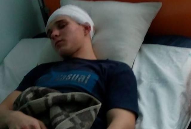 На Київщині підлітки по-звірячому побили сина чиновниці у новорічну ніч