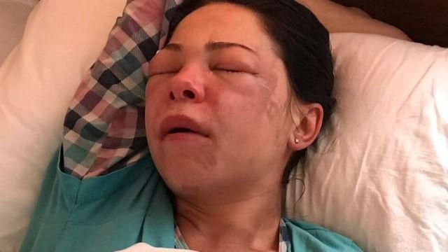 У Дніпрі жінку облили кислотою: з’явились фото У Дніпрі жінку облили кислотою: з’явились фото