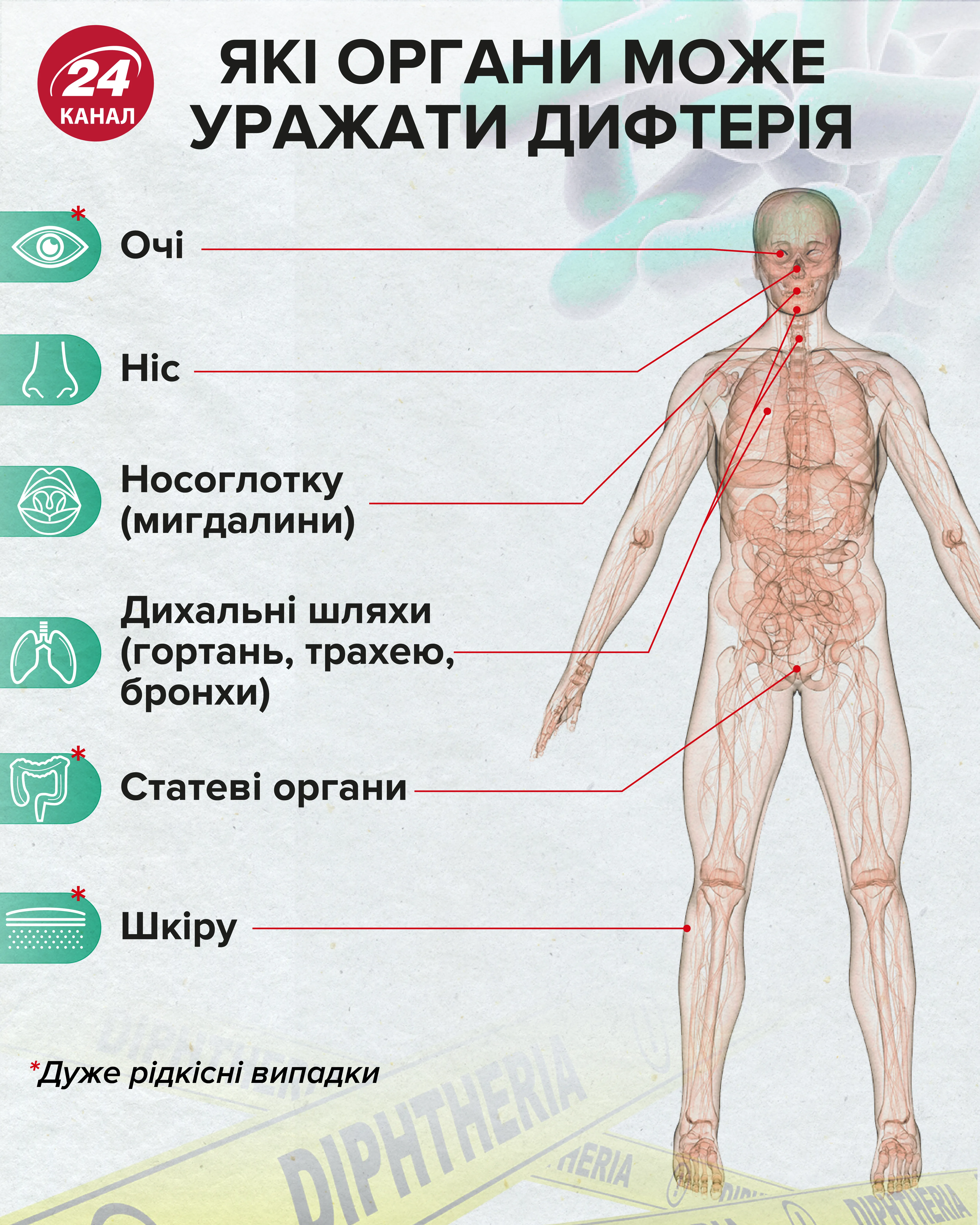 Дифтерия в Украине: симптомы у детей и взрослых, прививка, лечение