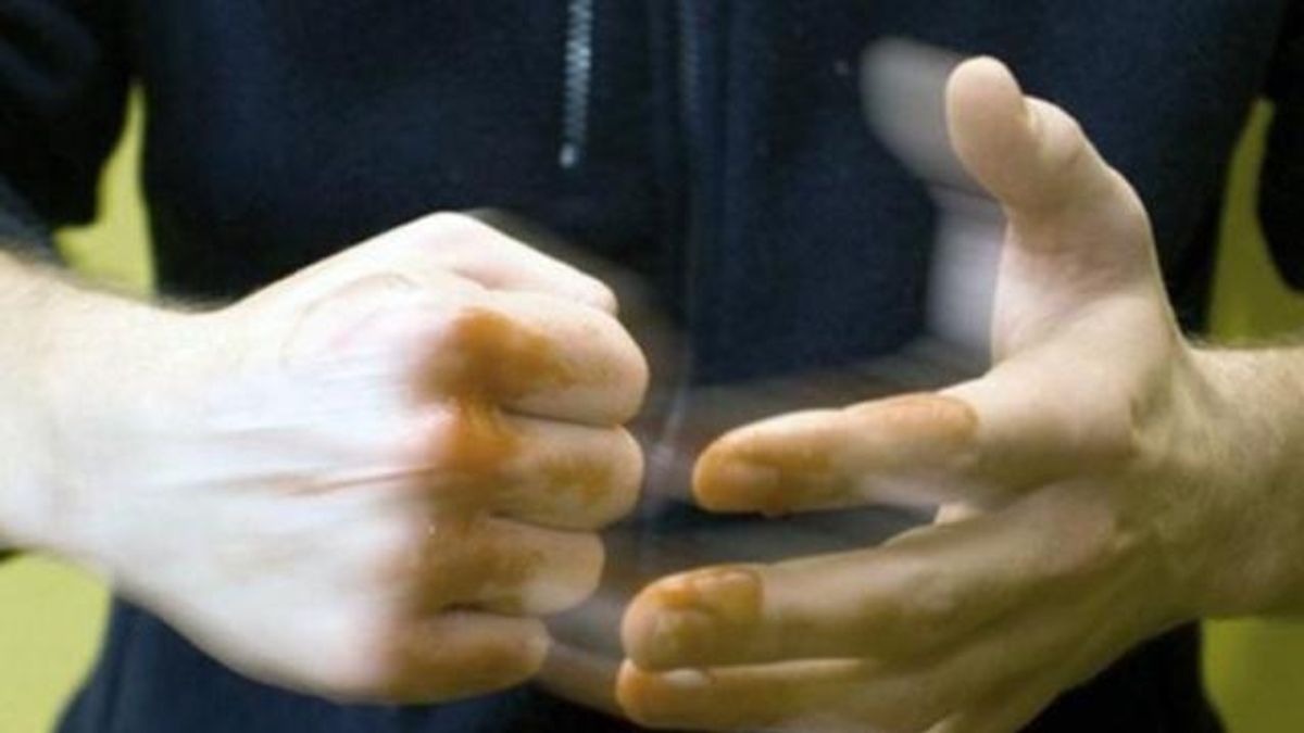 Підлітки до перелому побили школяра у Кропивницькому