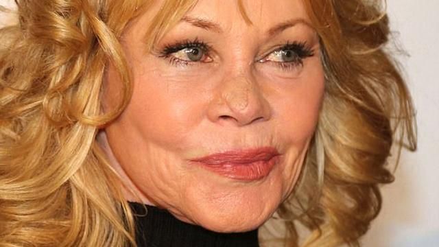 Актриса Мелані Гріффіт вперше вийшла на публіку після видалення пухлини на обличчі