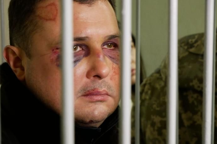 Избитый экс-нардеп Шепелев рассказал детали своего задержания