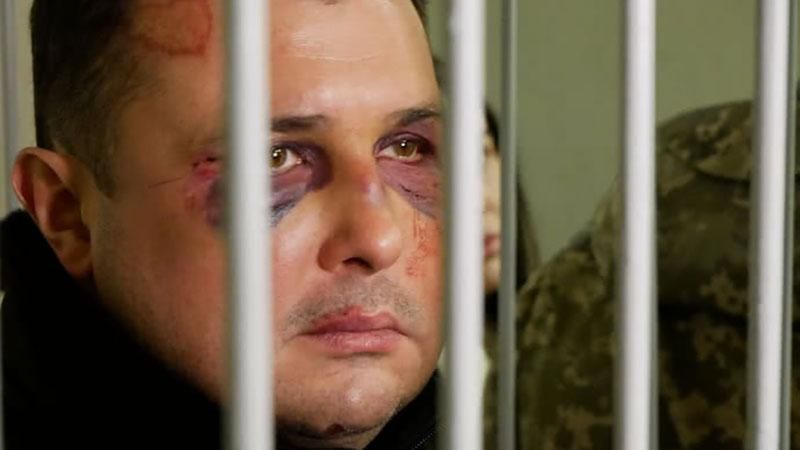 Рассмотрение дела экс-нардепа Шепелева: в суд вызвали медиков