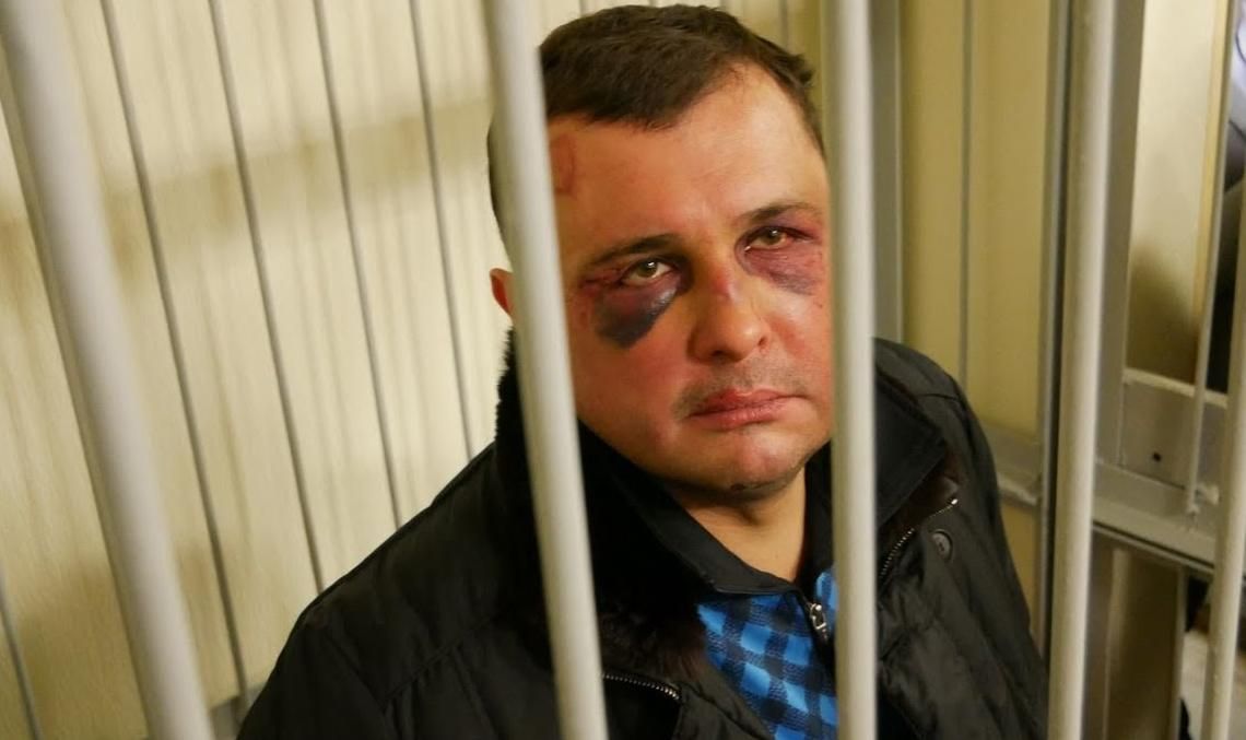 Матіос розповів про "загадкові обставини" та травми Шепелева під час затримання Матіос розповів про "загадкові обставини" та травми Шепелева під час затримання