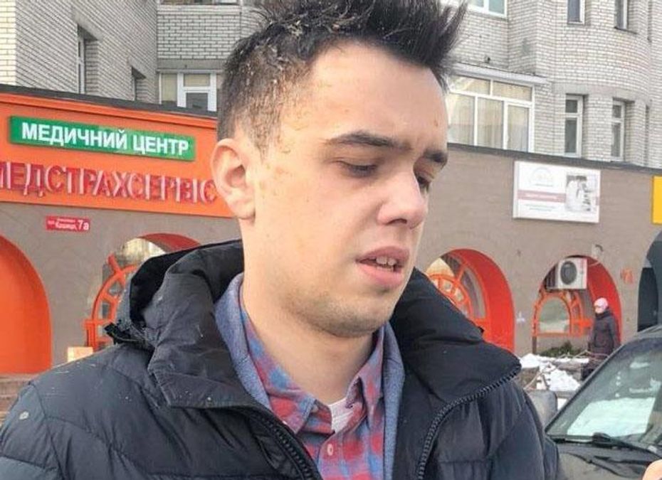 Известного блогера забросали яйцами в Киеве: фото и видео Известного блогера забросали яйцами в Киеве: фото и видео