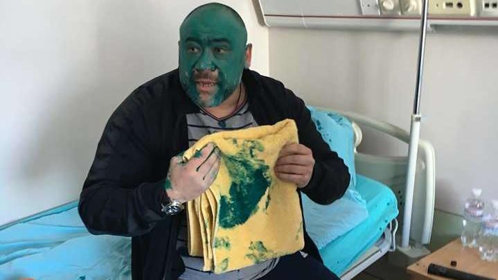 Супрун відреагувала на перебування тітушки Крисіна у дитячому відділенні Супрун відреагувала на перебування тітушки Крисіна у дитячому відділенні