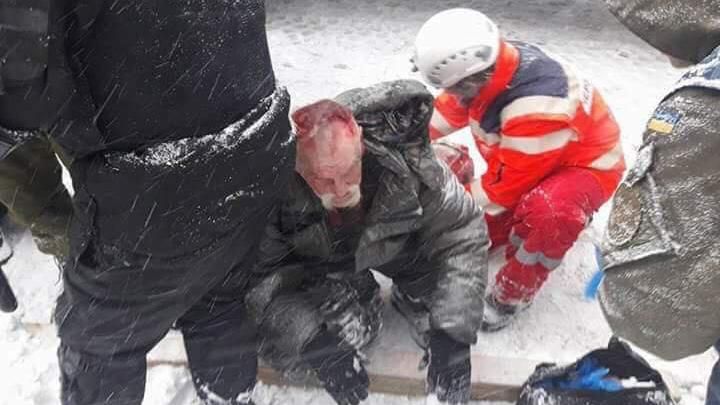 Травми голови та численні переломи: як виглядають активісти після штурму наметового містечка Травми голови та численні переломи: як виглядають активісти після штурму наметового містечка