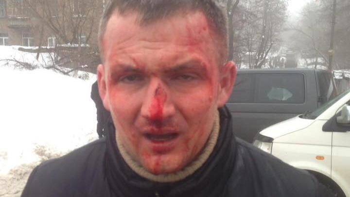 В полиции сообщили детали избиения нардепа Левченко в Киеве