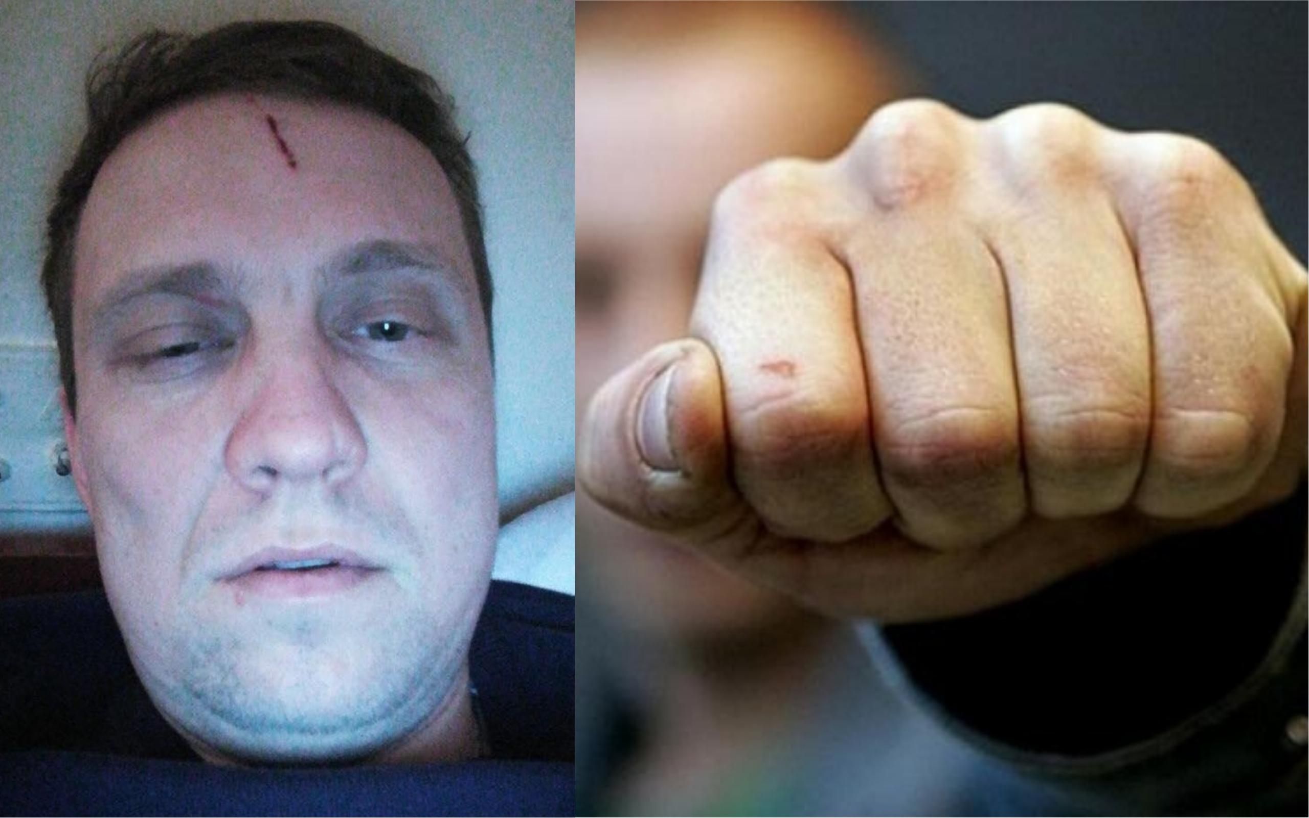 На Київщині побили депутата від УКРОПу: у партії назвали причину інциденту На Київщині побили депутата від УКРОПу: у партії назвали причину інциденту