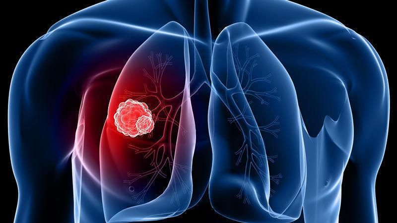 Парламент присоединился к празднованию Всемирного дня борьбы с туберкулезом Парламент присоединился к празднованию Всемирного дня борьбы с туберкулезом