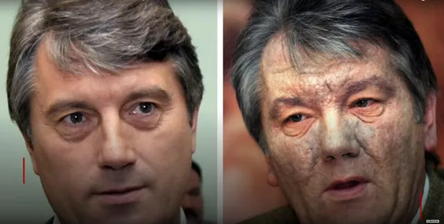 Віктор Ющенко отруєння Віктор Ющенко отруєння